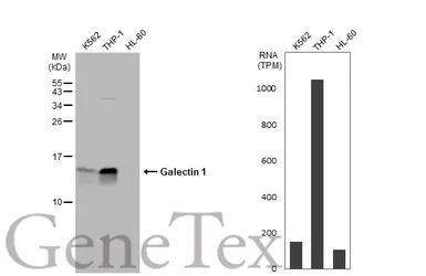 Anti-Galectin 1 antibody used in Western Blot (WB). GTX116411