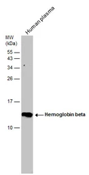 Anti-Hemoglobin beta antibody used in Western Blot (WB). GTX116412