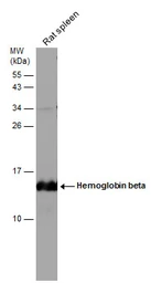 Anti-Hemoglobin beta antibody used in Western Blot (WB). GTX116412