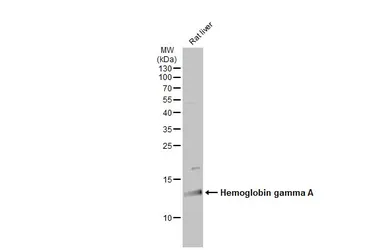 Anti-Hemoglobin gamma A antibody used in Western Blot (WB). GTX116413