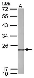 Anti-PRX IV antibody used in Western Blot (WB). GTX116414