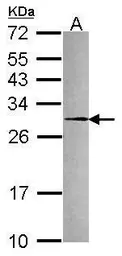 Anti-PRX IV antibody used in Western Blot (WB). GTX116414