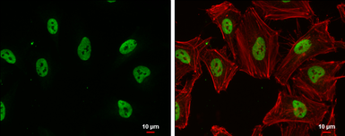Anti-SIN3B antibody [N1N2-2], N-term used in Immunocytochemistry/ Immunofluorescence (ICC/IF). GTX116417