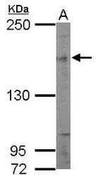 Anti-SIN3B antibody [N1N2-2], N-term used in Western Blot (WB). GTX116417