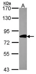 Anti-COG2 antibody [N1N2], N-term used in Western Blot (WB). GTX116423
