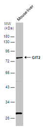 Anti-GIT2 antibody [N1N3] used in Western Blot (WB). GTX116427