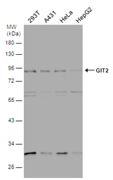 Anti-GIT2 antibody [N1N3] used in Western Blot (WB). GTX116427