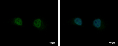 Anti-GIT2 antibody [N1N3] used in Immunocytochemistry/ Immunofluorescence (ICC/IF). GTX116427