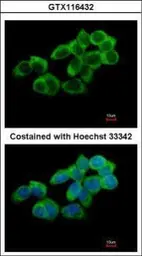 Anti-UBASH3A antibody [N1C1] used in Immunocytochemistry/ Immunofluorescence (ICC/IF). GTX116432