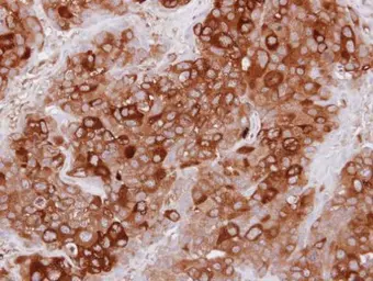Anti-UBASH3A antibody [N1C1] used in IHC (Paraffin sections) (IHC-P). GTX116432