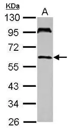 Anti-UBASH3A antibody [N1C1] used in Western Blot (WB). GTX116432