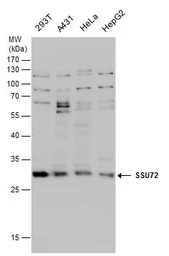 Anti-SSU72 antibody [N1C3] used in Western Blot (WB). GTX116436