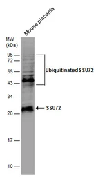 Anti-SSU72 antibody [N1C3] used in Western Blot (WB). GTX116436