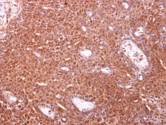 Anti-TOMM34 antibody [N1C3] used in IHC (Paraffin sections) (IHC-P). GTX116439