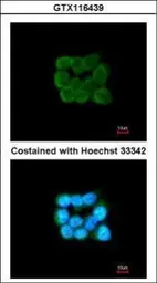 Anti-TOMM34 antibody [N1C3] used in Immunocytochemistry/ Immunofluorescence (ICC/IF). GTX116439