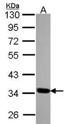Anti-TOMM34 antibody [N1C3] used in Western Blot (WB). GTX116439