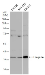 Anti-Langerin antibody [N2C3] used in Western Blot (WB). GTX116461