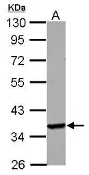 Anti-Langerin antibody [N2C3] used in Western Blot (WB). GTX116461