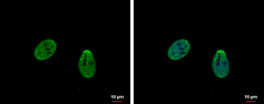 Anti-TRIP15 antibody used in Immunocytochemistry/ Immunofluorescence (ICC/IF). GTX116463