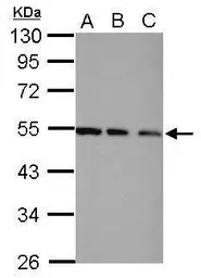 Anti-TRIP15 antibody used in Western Blot (WB). GTX116463