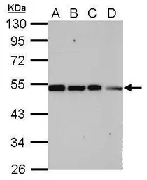 Anti-TRIP15 antibody used in Western Blot (WB). GTX116463