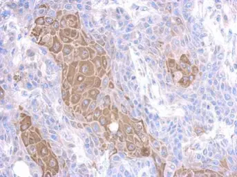 Anti-MMP23 antibody [N2C3] used in IHC (Paraffin sections) (IHC-P). GTX116474