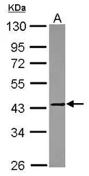 Anti-MMP23 antibody [N2C3] used in Western Blot (WB). GTX116474