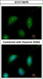 Anti-C2CD2 antibody used in Immunocytochemistry/ Immunofluorescence (ICC/IF). GTX116476