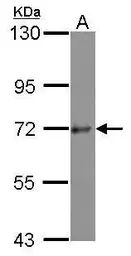 Anti-PKC nu antibody [N1N3] used in Western Blot (WB). GTX116489