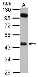Anti-FCRLM1 antibody used in Western Blot (WB). GTX116506