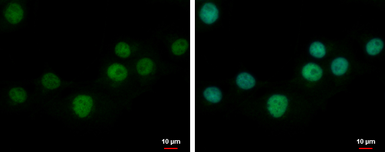 Anti-ZNF501 antibody [N2C3] used in Immunocytochemistry/ Immunofluorescence (ICC/IF). GTX116521