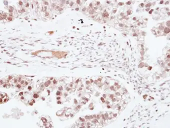 Anti-ZNF501 antibody [N2C3] used in IHC (Paraffin sections) (IHC-P). GTX116521