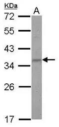 Anti-ZNF501 antibody [N2C3] used in Western Blot (WB). GTX116521
