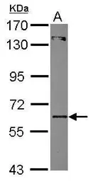 Anti-ZNF449 antibody used in Western Blot (WB). GTX116524