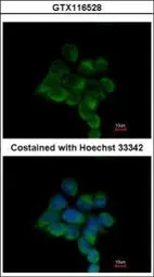 Anti-ILKAP antibody [N2C3] used in Immunocytochemistry/ Immunofluorescence (ICC/IF). GTX116528