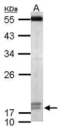 Anti-PPIL3 antibody [N1C3] used in Western Blot (WB). GTX116555