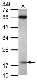 Anti-PPIL3 antibody [N1C3] used in Western Blot (WB). GTX116555