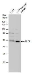 Anti-NLE1 antibody used in Western Blot (WB). GTX116568