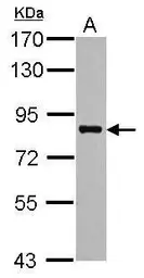 Anti-PRMT7 antibody used in Western Blot (WB). GTX116569