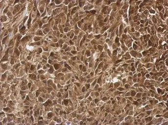 Anti-PRMT7 antibody used in IHC (Paraffin sections) (IHC-P). GTX116570
