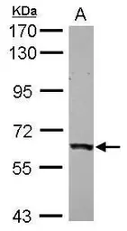 Anti-PHD4 antibody used in Western Blot (WB). GTX116582