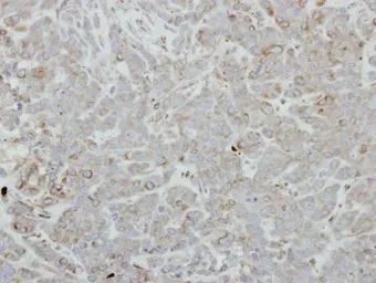 Anti-FBLIM1 antibody [N3C3] used in IHC (Paraffin sections) (IHC-P). GTX116584