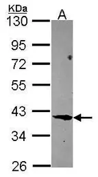 Anti-FBLIM1 antibody [N3C3] used in Western Blot (WB). GTX116584