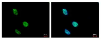 Anti-KLHDC4 antibody used in Immunocytochemistry/ Immunofluorescence (ICC/IF). GTX116585