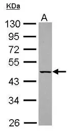 Anti-KLHDC4 antibody used in Western Blot (WB). GTX116585
