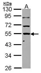 Anti-KLHDC4 antibody used in Western Blot (WB). GTX116586
