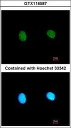 Anti-MED18 antibody [N1C3] used in Immunocytochemistry/ Immunofluorescence (ICC/IF). GTX116587