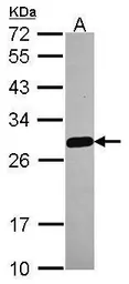 Anti-MED18 antibody [N1C3] used in Western Blot (WB). GTX116587