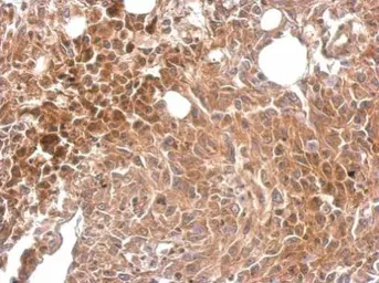 Anti-MKS1 antibody [N2C1], Internal used in IHC (Paraffin sections) (IHC-P). GTX116593