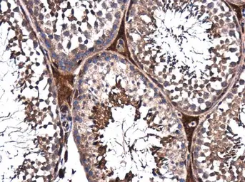 Anti-PPP2R2D antibody [N2C3] used in IHC (Paraffin sections) (IHC-P). GTX116609